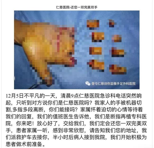 为什么新疆满地都是“手指掉了到仁慈医院”的户外广告？